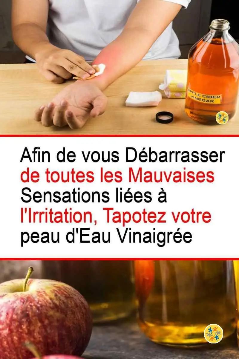 Le vinaigre de cidre remède naturel anti-irritations